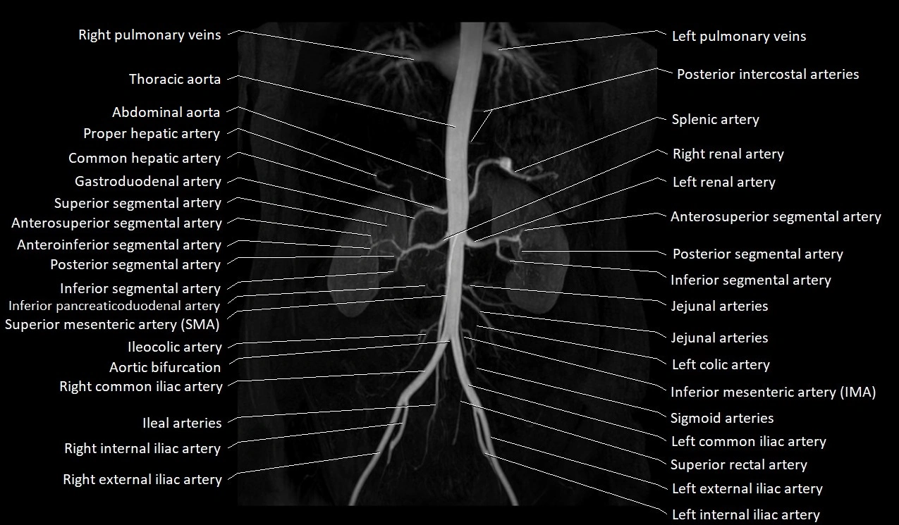 MRA abdomen (renal and mesenteric) angiography MIP 3D anatomy image 1.webp